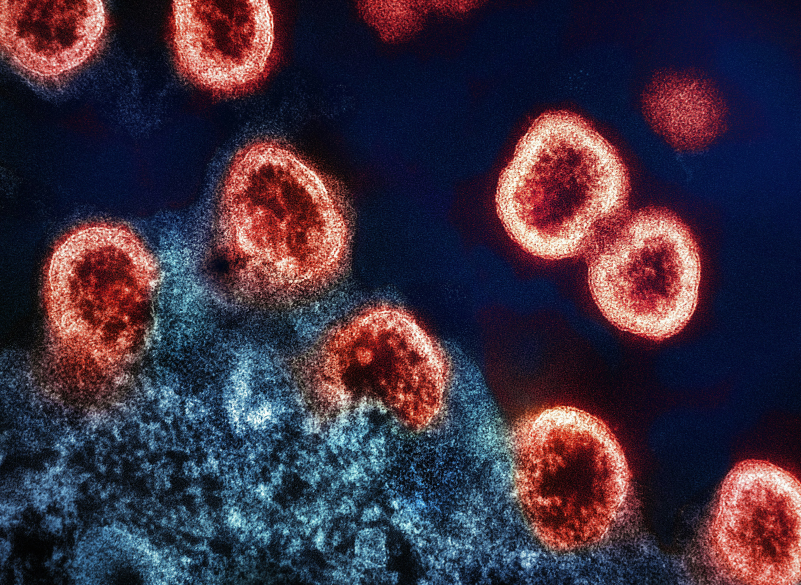 How Your Immune System Protects You Every Day